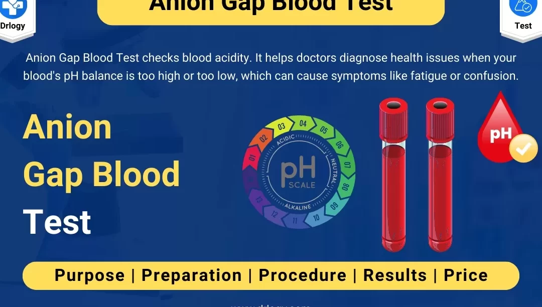 Calculadora de Brecha Aniónica en la Orina Experto ABG en la App Store