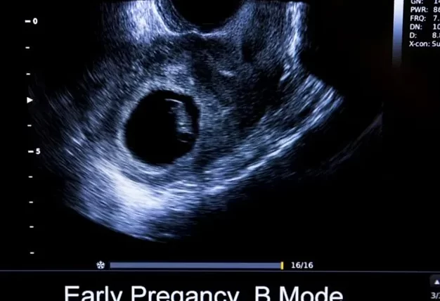Tabla de medición de la longitud corona-rabadilla (CRL)