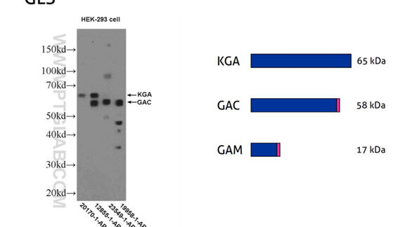 ¿Por qué el peso molecular de mi proteína difiere del ...