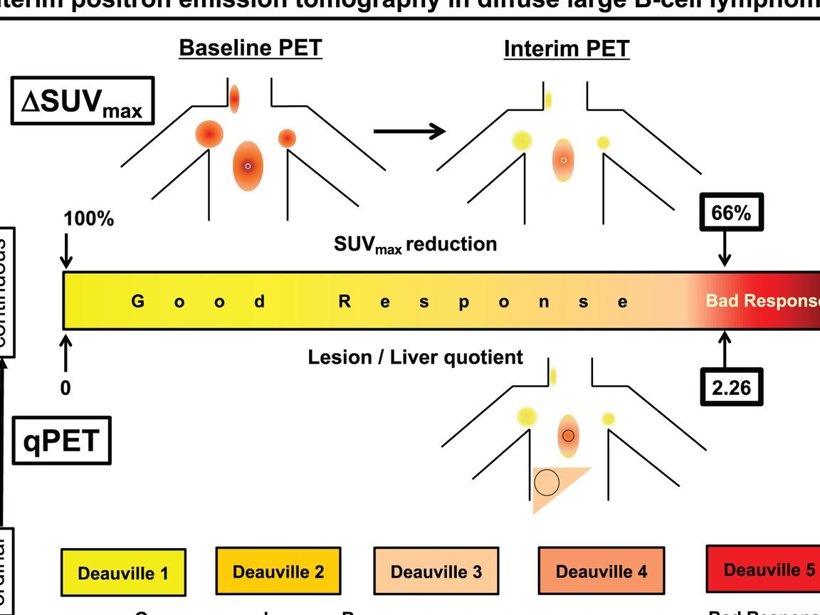 La radiómica PET de referencia supera la puntuación de riesgo IPI para ...