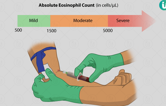 4 formas de calcular el volumen de sangre - wikiHow