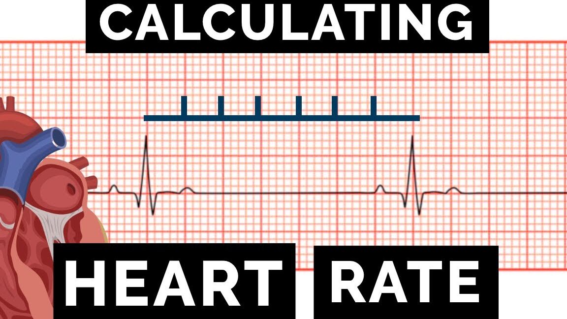 Calculadora de Ritmo Cardíaco ECG Calcular la frecuencia cardíaca en un ECG |